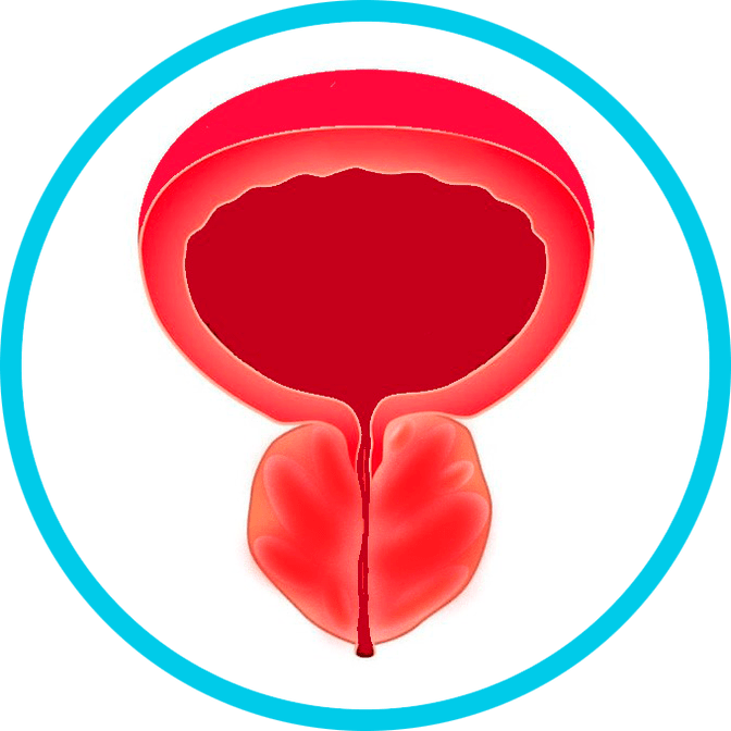 Síntomas de prostatite